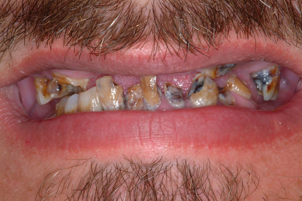 Patient Pritchard Before Smile